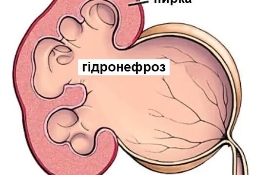 Починаємо рік із складних операцій — і впевнених результатів